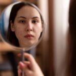 How to Get Rid of Acne Scars: Tips and Treatments